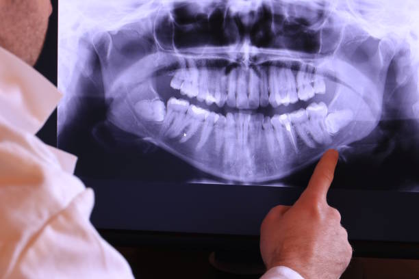 Best Emergency Denture Repair in Totowa, NJ