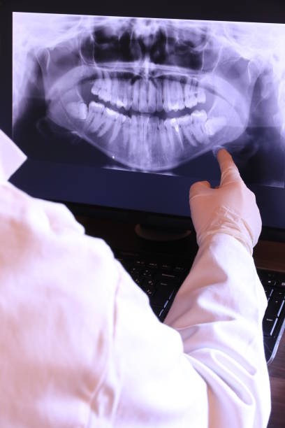Best Emergency Gum Treatment in Totowa, NJ