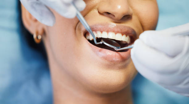 Best Emergency Wisdom Teeth Removal in Totowa, NJ